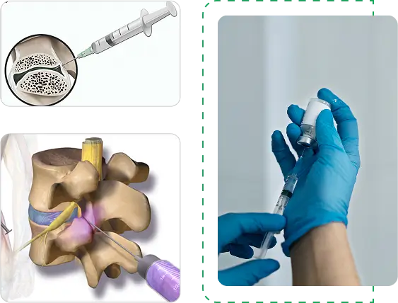 facet joint injections