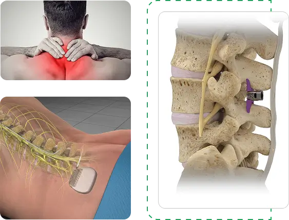minimally invasive surgical procedures