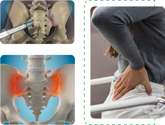 sacroiliac joint steroid injection